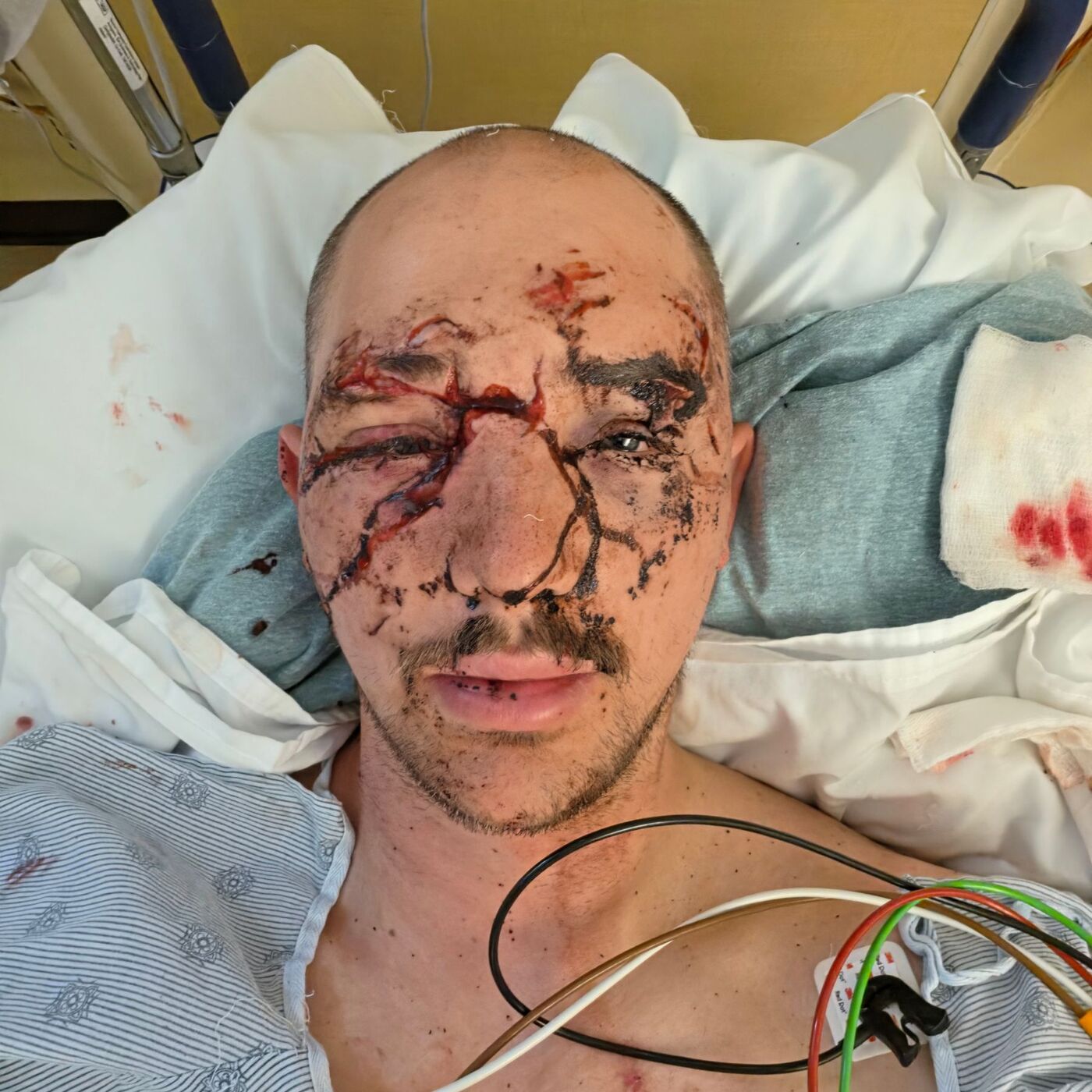 ‘I could hear all the bones crunching’: Bear attack survivor speaks out episode artwork