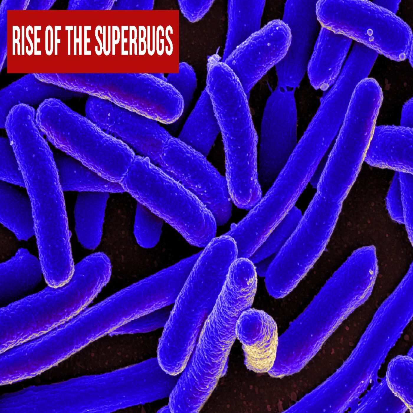 Ep. #342: Rise of the Superbugs w/ Michael Graziano