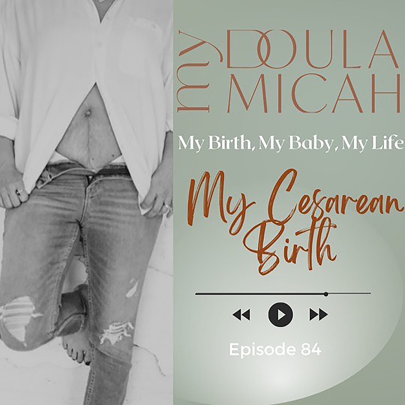 My Cesarean Birth